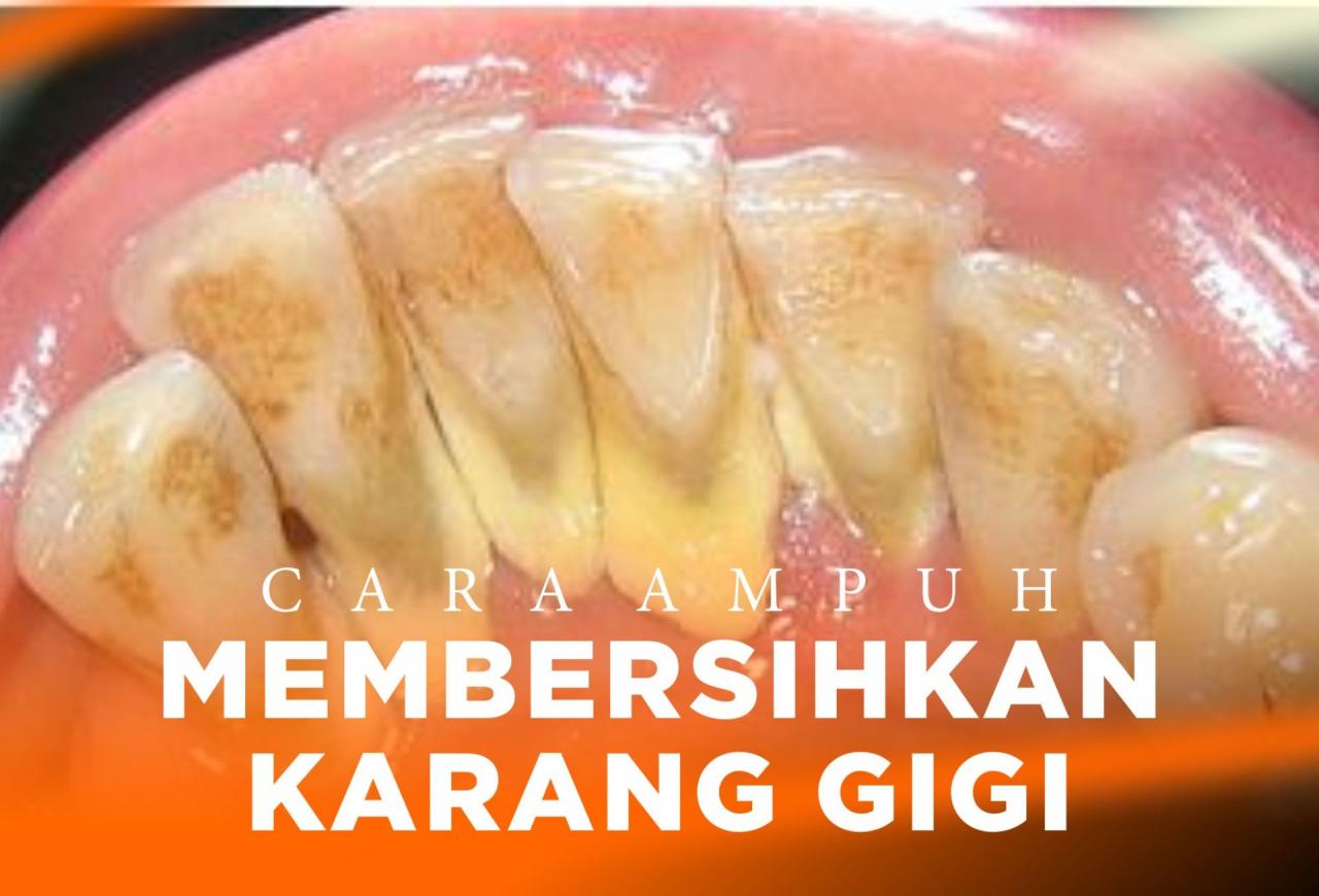 Cara Menghilangkan Karang
