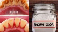 Membersihkan Karang Gigi Dengan Baking Soda