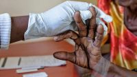 Kamerun Mulai Program Vaksinasi Malaria Pertama di Dunia