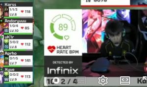 Seperti di MPL! Inilah Cara Menampilkan Heart Rate Anda di Streaming Menggunakan Apple Watch!