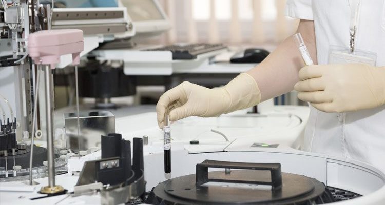 Pola Makan Sehat untuk Menjaga Kesehatan Jantung