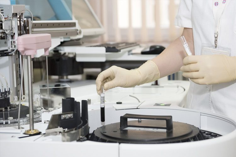 Pola Makan Sehat untuk Menjaga Kesehatan Jantung