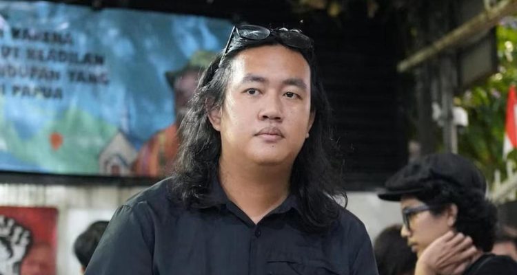 Kerusakan Mata Andrie Yunus: Hanya Mampu Membedakan Cahaya