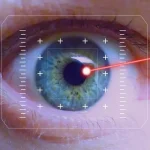 Lasik Mata: Semua yang Perlu Anda Ketahui