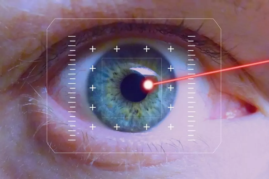 Lasik Mata: Semua yang Perlu Anda Ketahui