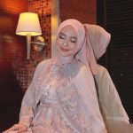 Ria Ricis Akui Jalani Operasi Plastik Demi Kesehatan