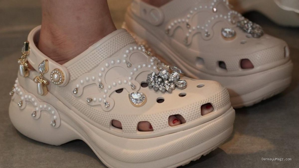 Crocs: Dari Sepatu Terjelek Menjadi Penguasa Pasar Global