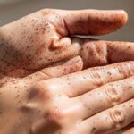12 Cara Ampuh Hilangkan Bau Amis di Tangan Pakai Bahan Dapur